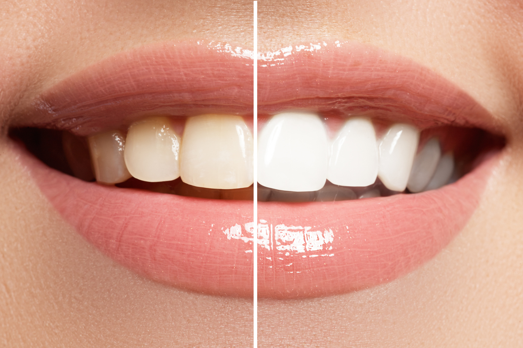 whitening products