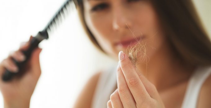 postpartum hair loss