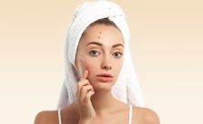 best skincare for adult acne