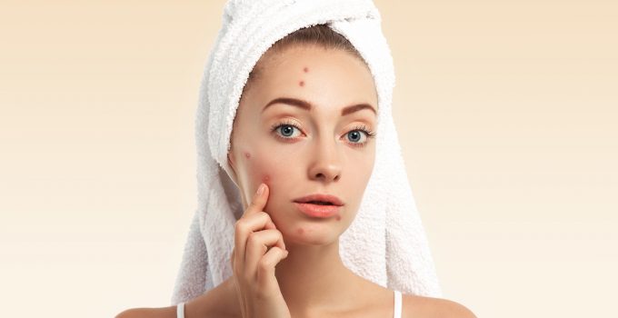 best skincare for adult acne