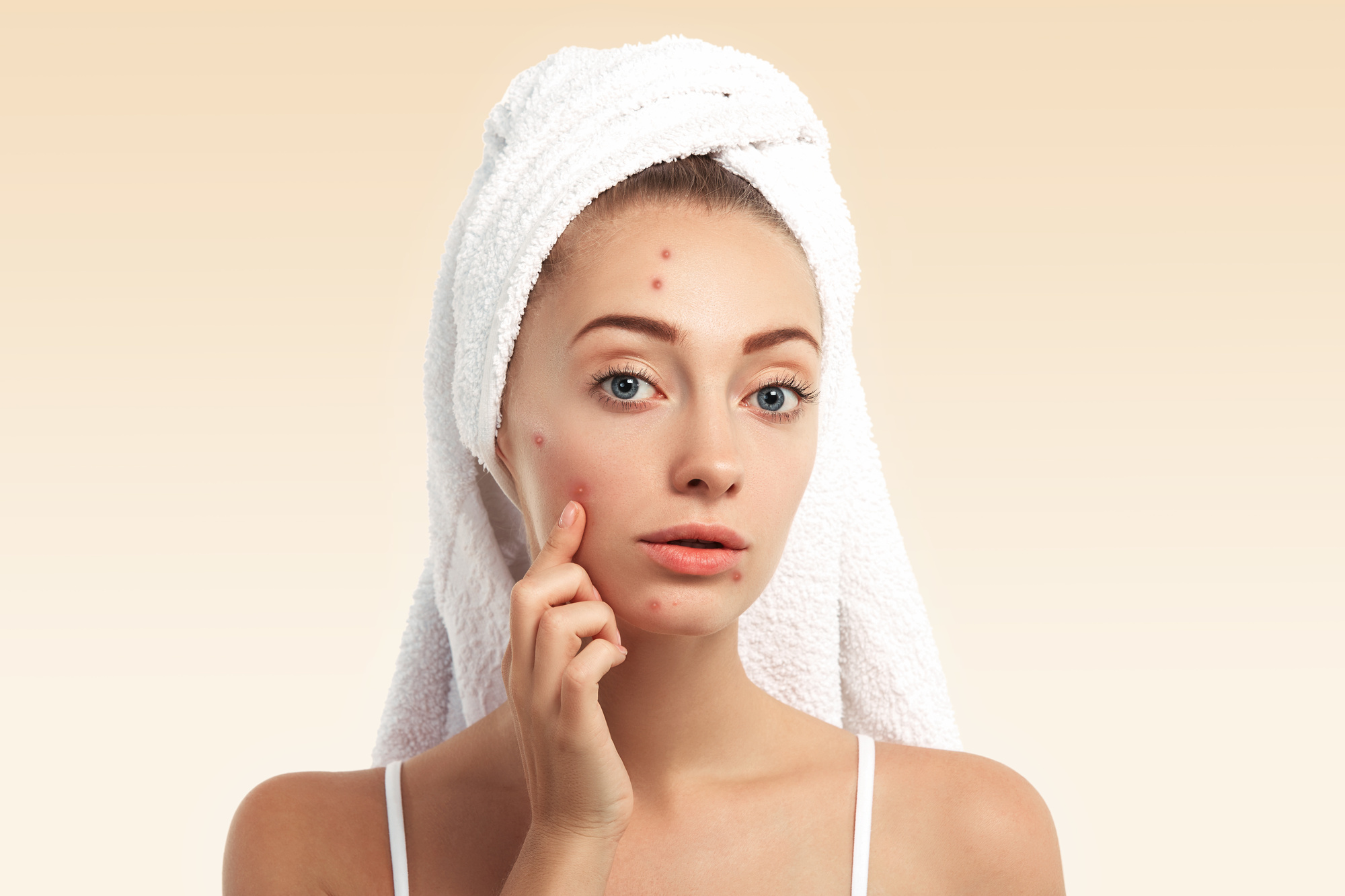 best skincare for adult acne